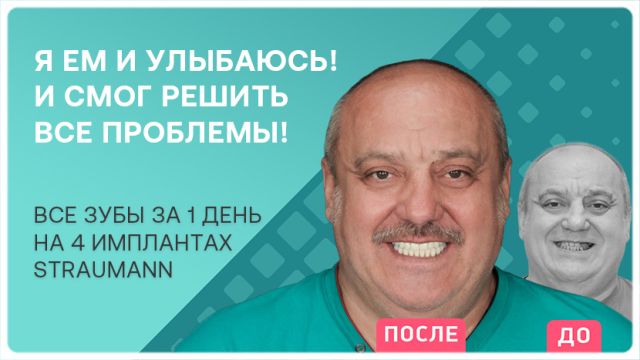 Технология ALL-ON-4