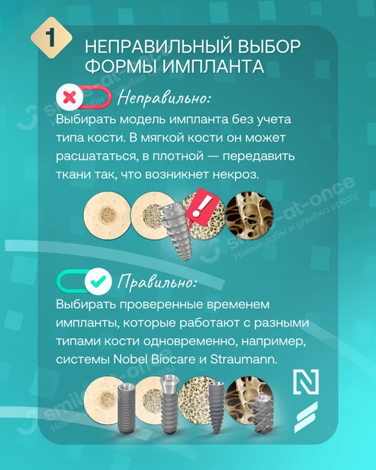 Ошибки врача - Как обезопасить себя при имплантации? 9 частых врачебных ошибок - Слайд 3