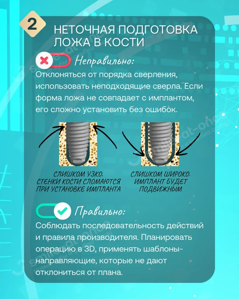 Ошибки врача - Как обезопасить себя при имплантации? 9 частых врачебных ошибок - Слайд 2