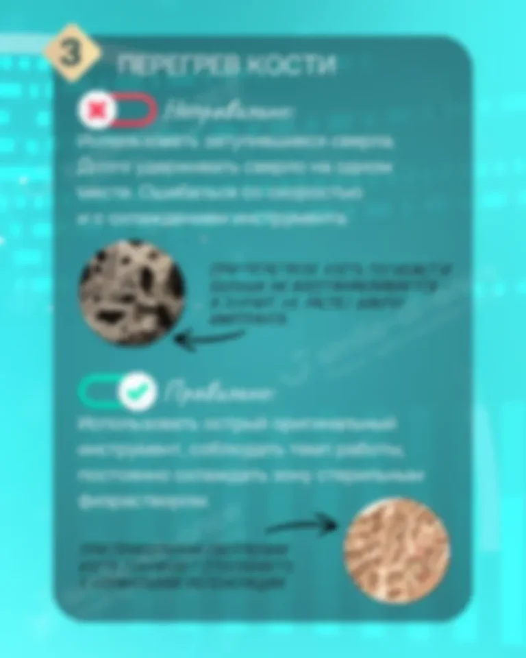Ошибки врача - Как обезопасить себя при имплантации? 9 частых врачебных ошибок - Слайд 5