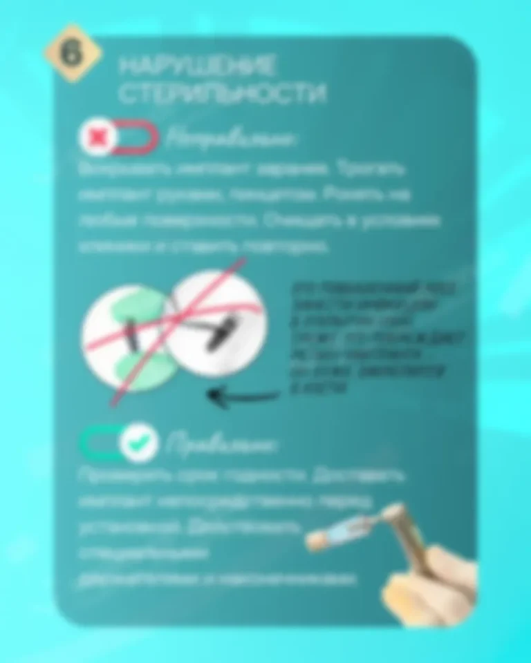 Ошибки врача - Как обезопасить себя при имплантации? 9 частых врачебных ошибок - Слайд 6