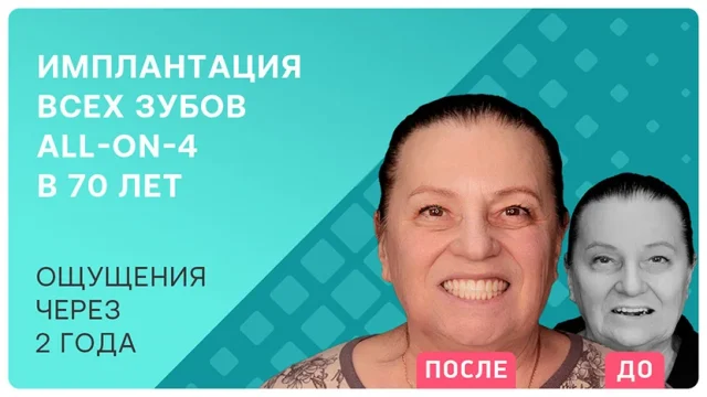 ALL-ON-4 в 70 лет