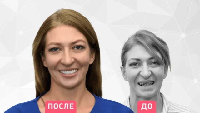 Почему импланты не приживаются и как этого избежать