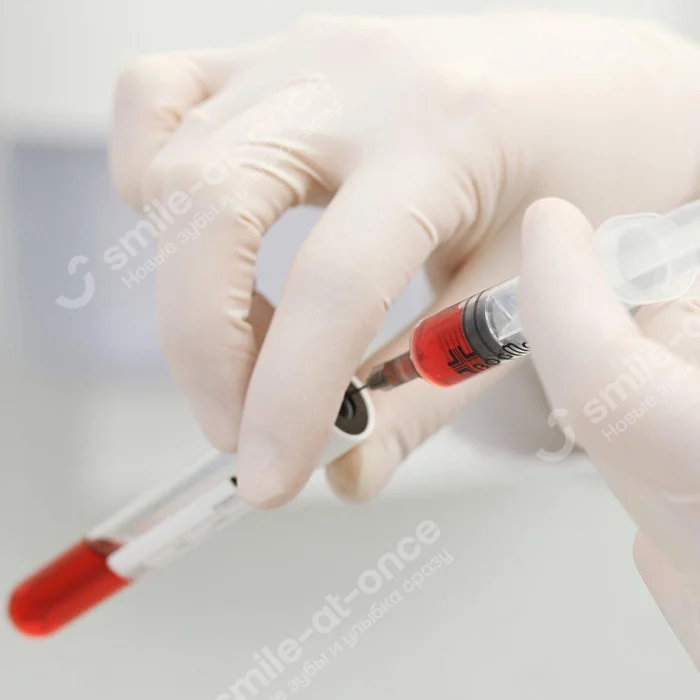 Взятие крови перед имплантацией зубов